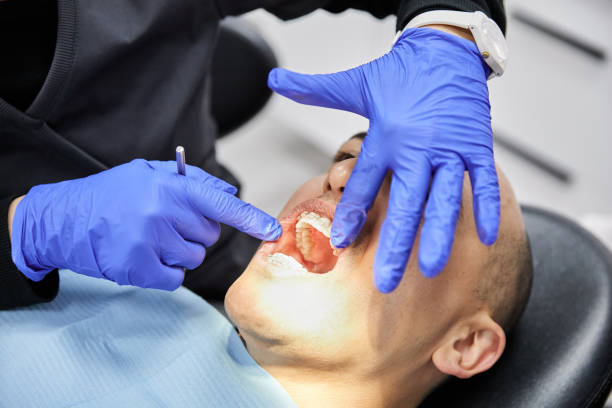 Best Emergency Treatment for Dental Infections or Abscesses in Parsons, TN