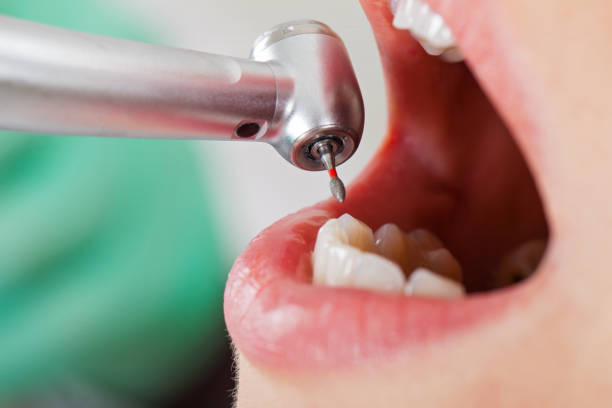 Best Urgent Care for Lost Fillings or Crowns in Parsons, TN